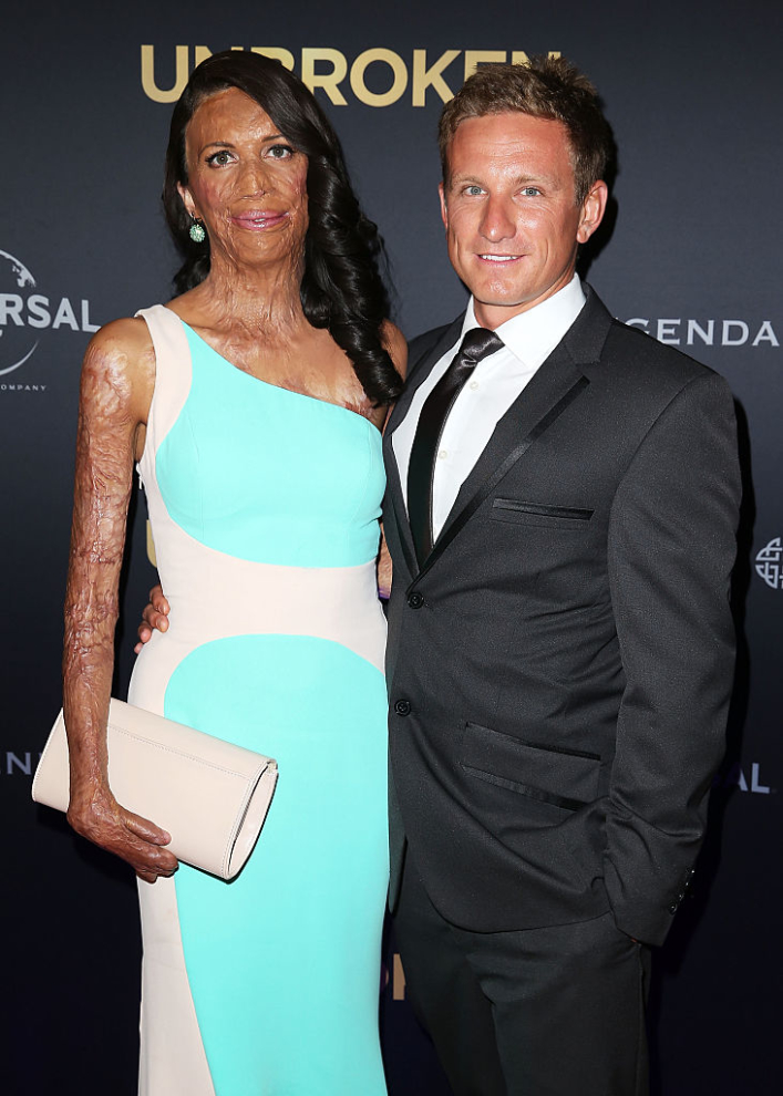 Turia Pitt và Michael Hoskin đến dự buổi công chiếu phim "Unbroken" tại Nhà hát bang Sydney (Úc) vào ngày 17 tháng 11 năm 2014. (© Getty Images | Brendon Thorne)