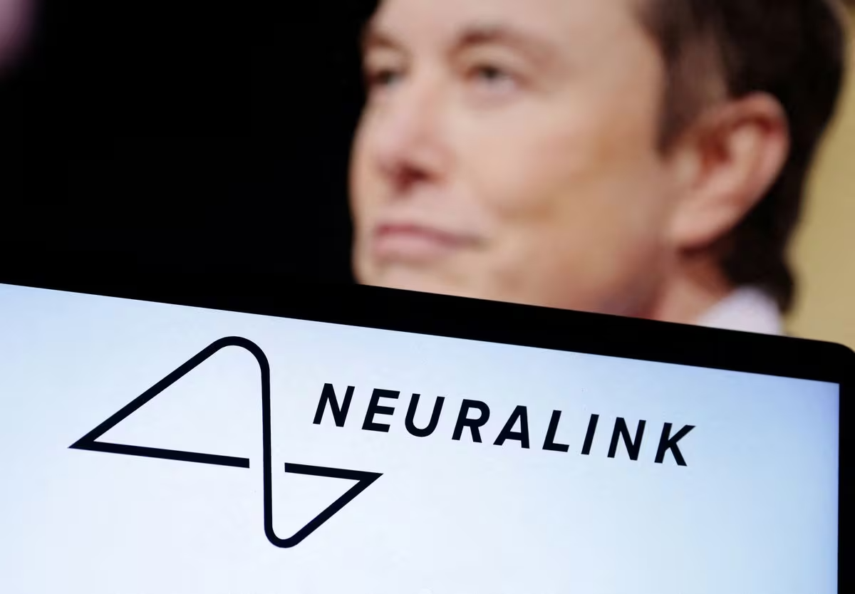 Công ty của Elon Musk cấy chip não lên người| Tân Thế Kỷ