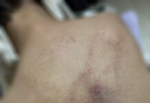 Điều tra phản ánh bé gái 4 tuổi ở Hà Nội bị cô giáo đánh, kéo lê, ném vào tường