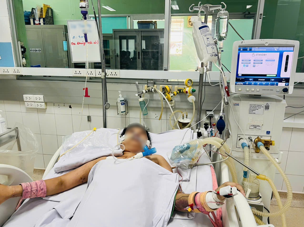 Sốt xuất huyết Dengue tăng nhanh, nhiều ca mắc ‘thập tử nhất sinh’